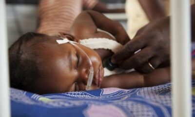 Κονγκό: Ξεπερνούν τους 400 οι νεκροί φέτος από επιδημία ιλαράς