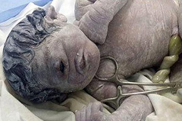 Μωρό Κύκλωπας γεννήθηκε στην Αίγυπτο | Παράξενες Ειδήσεις