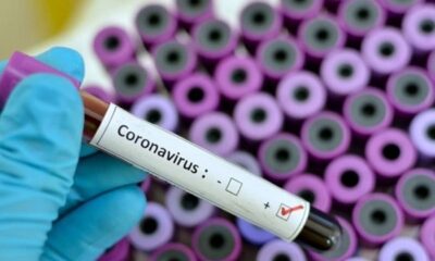 Αυστραλοί επιστήμονες ισχυρίζονται ότι βρήκαν μια θεραπεία για τον κορωνoϊό και ελπίζουν να ξεκινήσουν τις κλινικές δοκιμές έως το τέλος του μήνα. | Κορωνoϊός Ειδήσεις